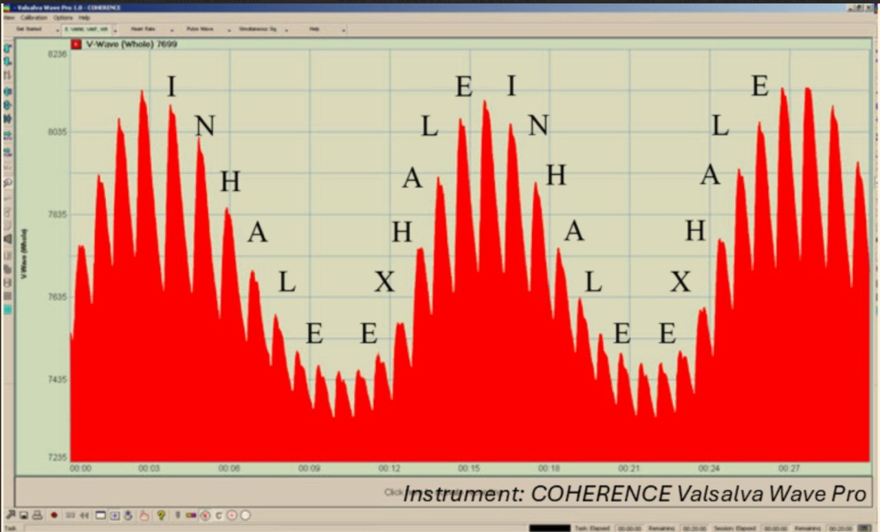 Valsalva Wave measurement